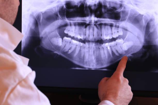 Best After-Hours Dental Trauma Care in Cleora, OK