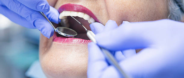 Best Emergency Tooth Extraction in Cleora, OK